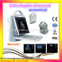 (CU23i) best ultrasound machine color doppler/ultrasound color doppler with convex and linear probe